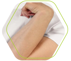 Toxina Botulínica para Espasticidade