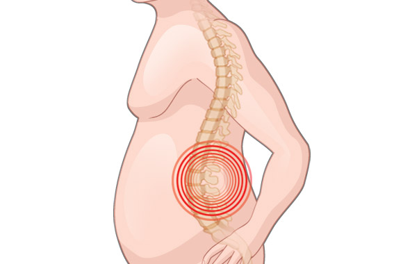 Obesidade e a dor nas costas
